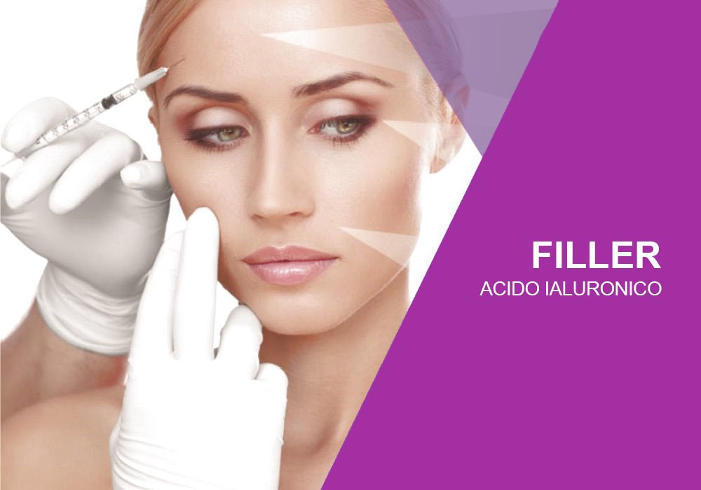 Filler acido ialuronico trattamento viso
